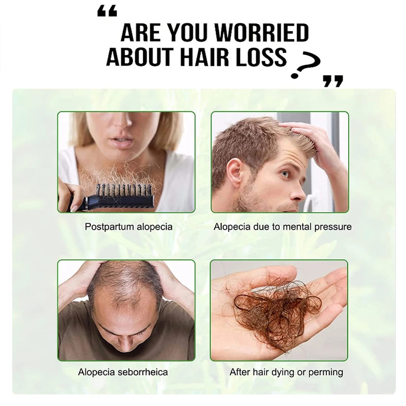 Goiple Rosemary Hair Growth Oil Serum Mint Essential Oil