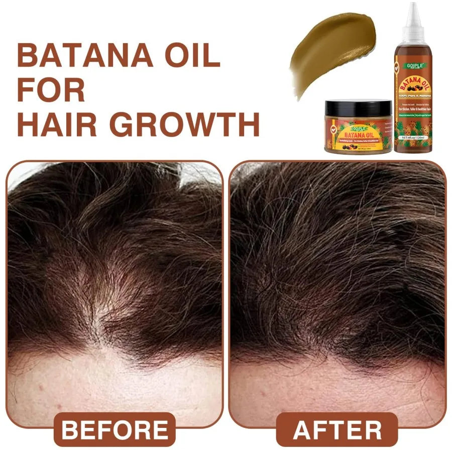 Goiple Batana Oil Hair Growth Serum For Thick Healthy Hair