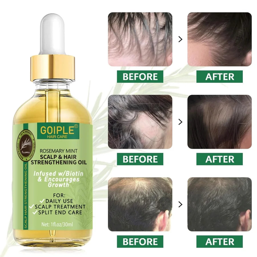 Goiple Rosemary Hair Growth Oil Serum Mint Essential Oil