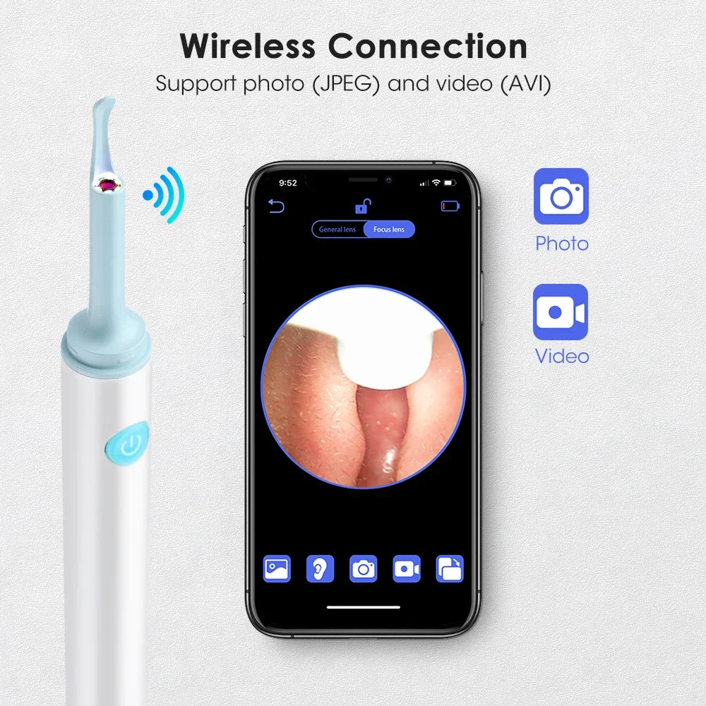 Hailicare Smart Ear Cleaner With Camera WiFi And LED Lights