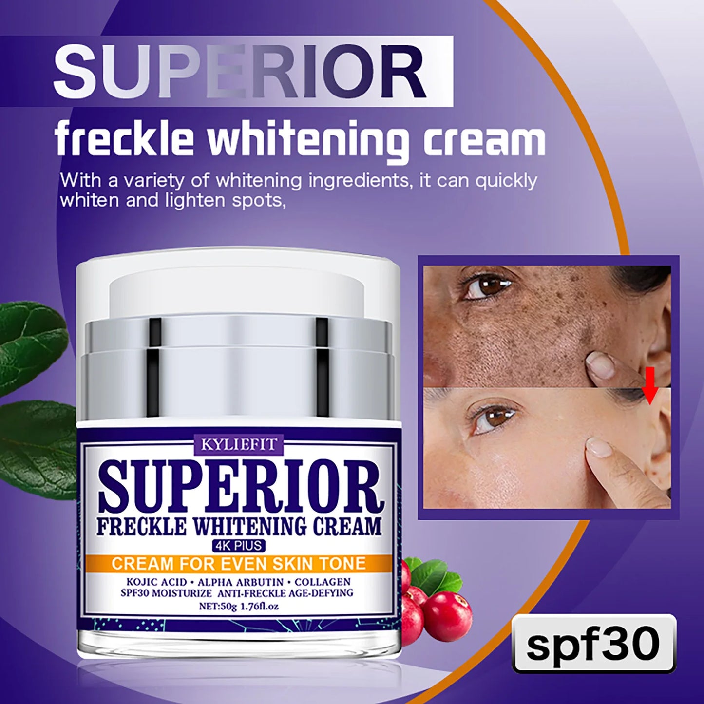AILKE Dark Spot Remover for Hyperpigmentation and Freckles