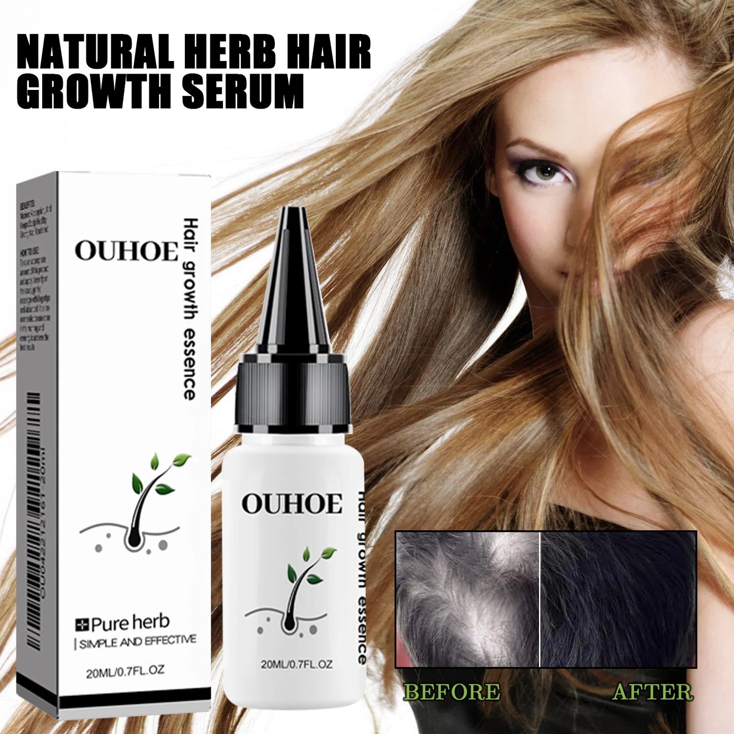 Ouhoe Herbal Dense Hair Essence For Scalp Care And Growth