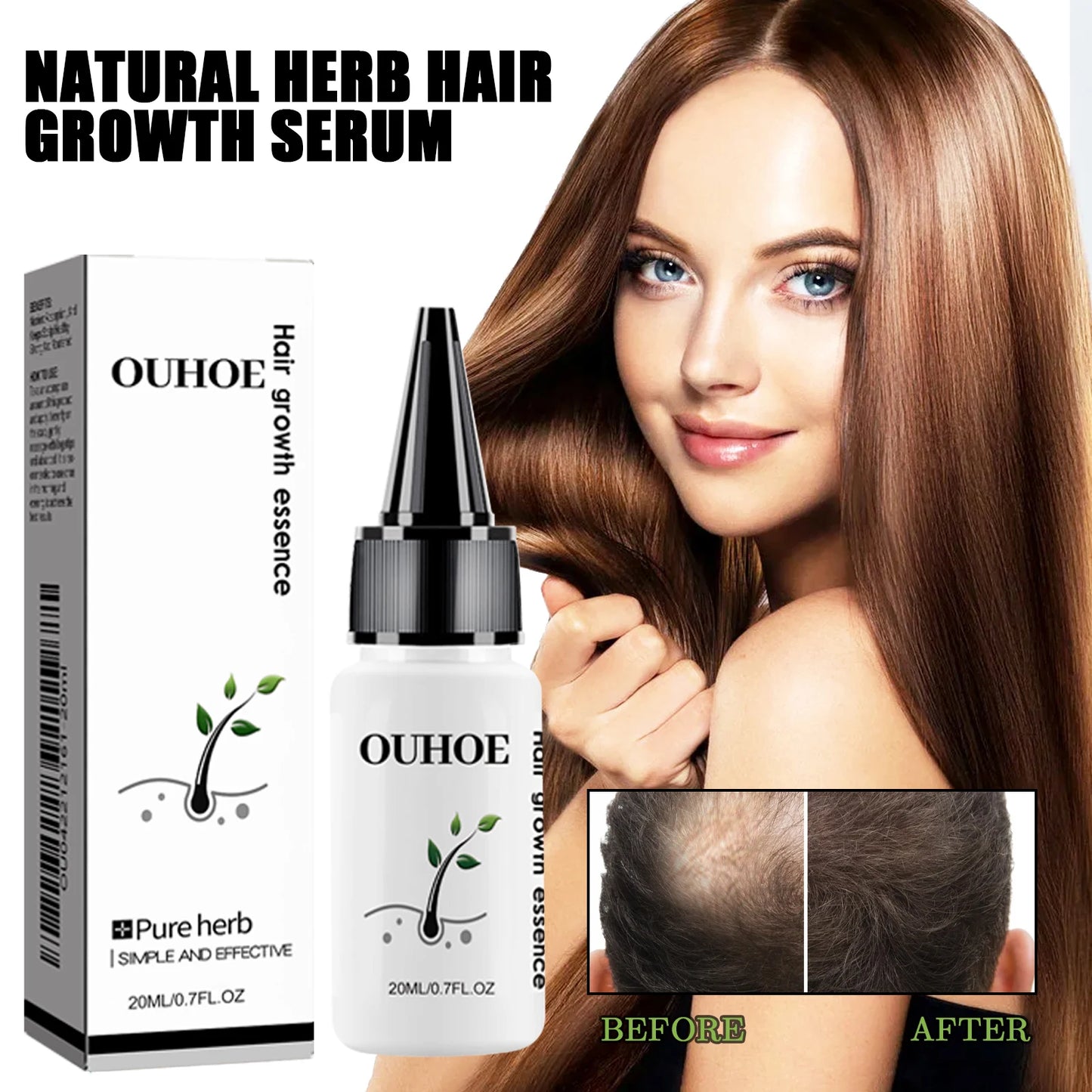 Ouhoe Herbal Dense Hair Essence For Scalp Care And Growth