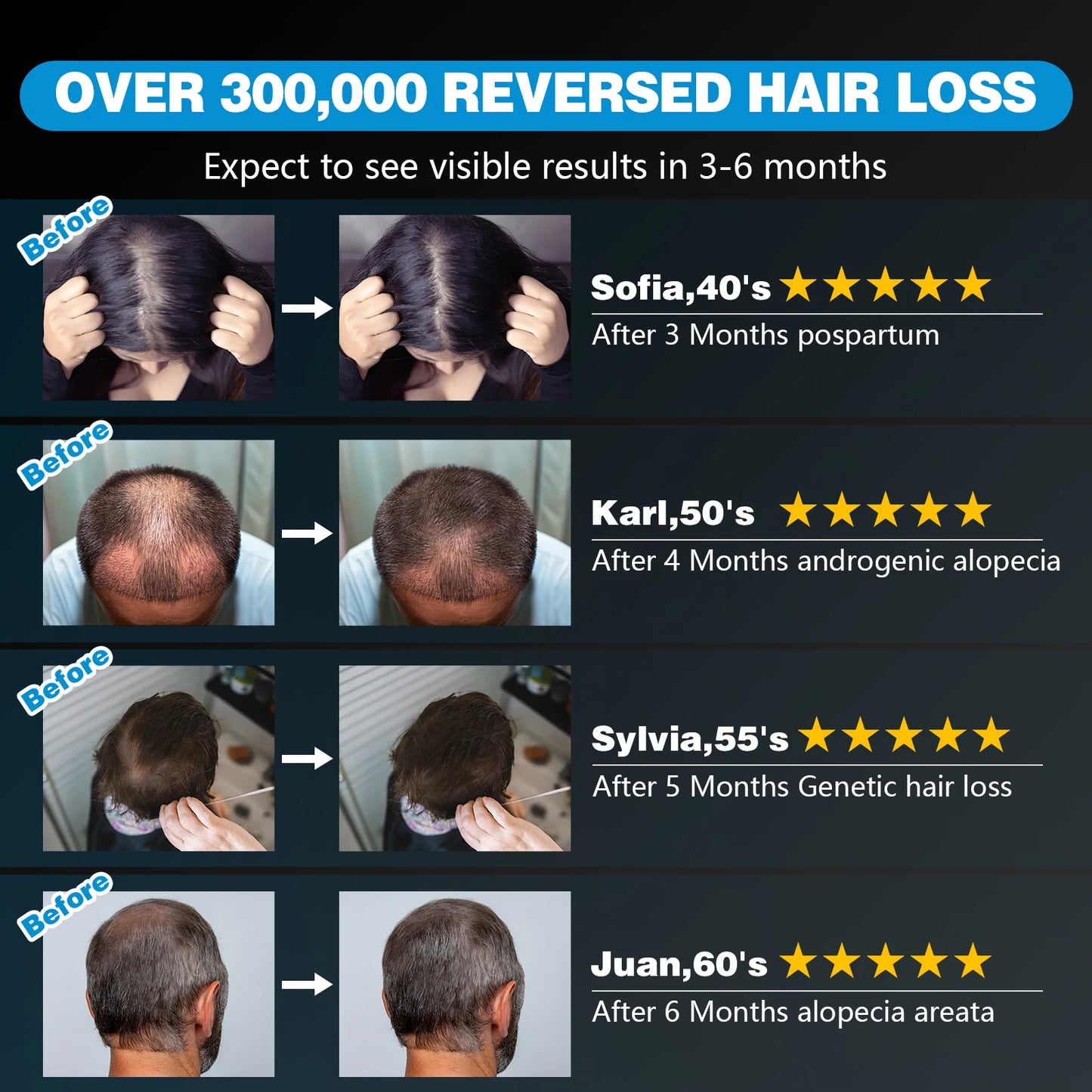 External Battery 120 Diodes Red Light Therapy Hair Cap