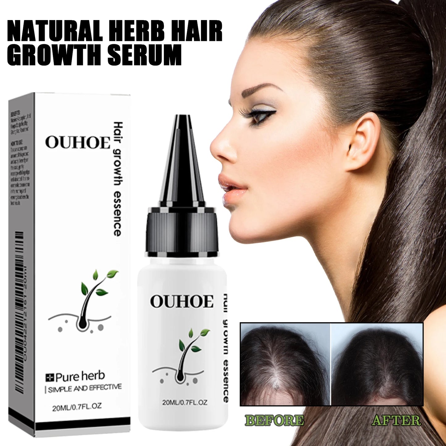 Ouhoe Herbal Dense Hair Essence For Scalp Care And Growth