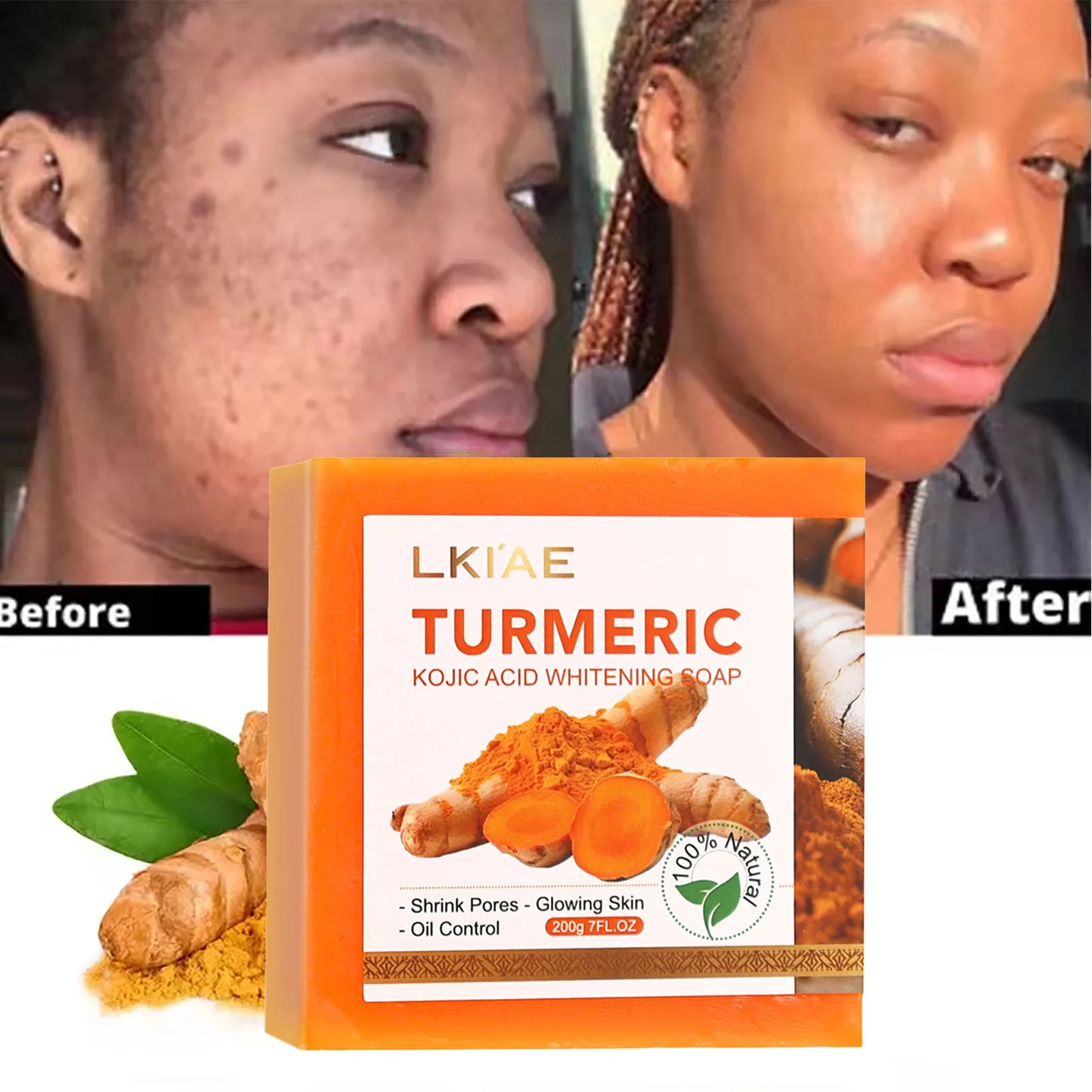AILKE Turmeric Whitening Skin Care Set With Glutathione Aloe